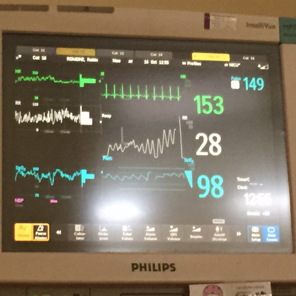 Heartrate very stable during cuddle